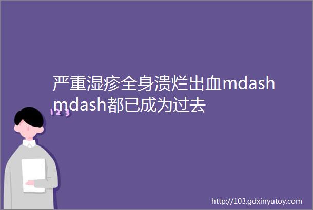 严重湿疹全身溃烂出血mdashmdash都已成为过去